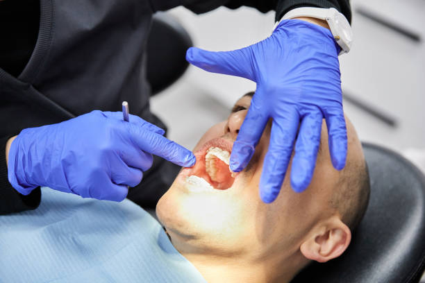 Best Emergency Treatment for Dental Infections or Abscesses in Middletown, OH